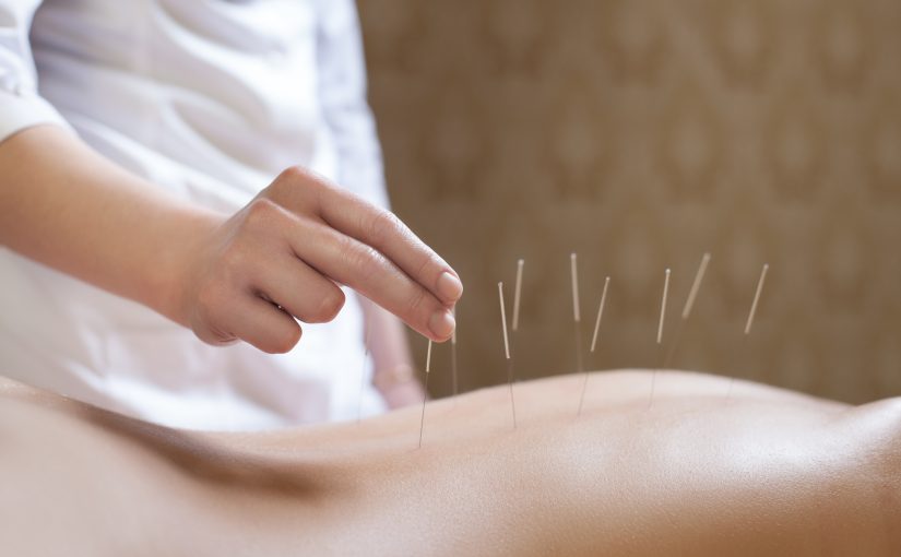 Simple Cures provide the best pain relief - acupuncture - experiences in Toronto