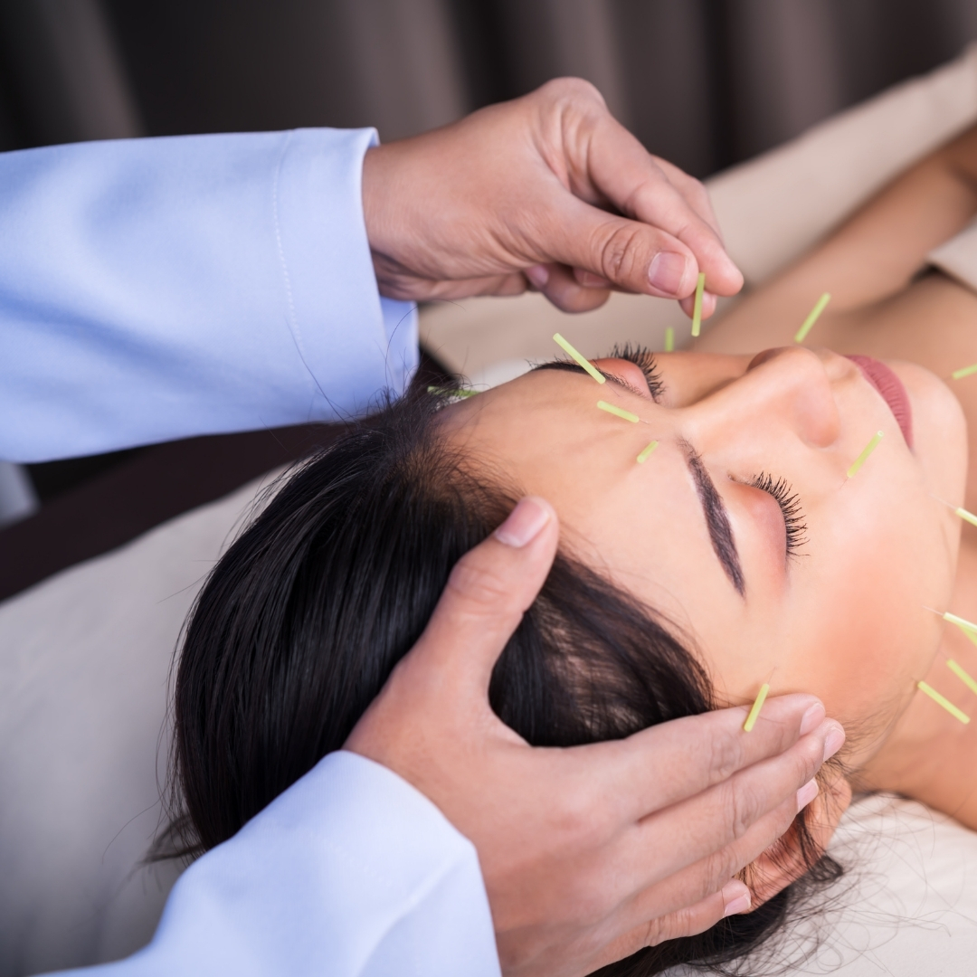 Cosmetic Acupuncture Service Toronto